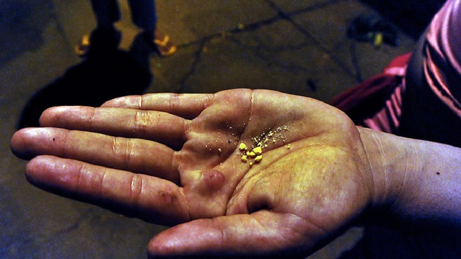 Fotografia em vista superior da palma de uma mão, com manchas de fuligem e algumas queimaduras, onde pode-se ver uma pequena porção de pedras de crack de cor amarelada. Tráfico.